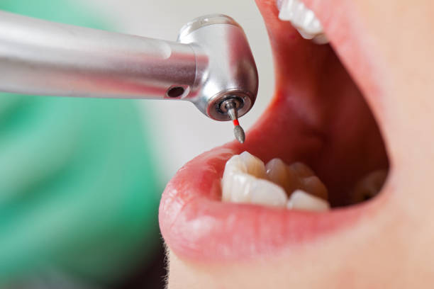 Best Tooth Infection Emergency Dentist  in Gun Barrel City, TX
